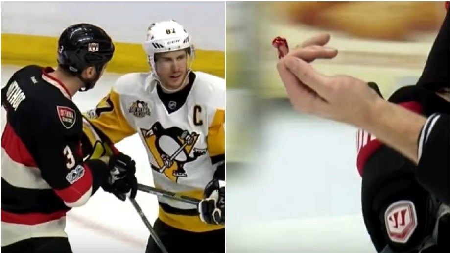 Le golpea con un stick a traición y le corta el dedo en dos Le golpea con un stick a traición y le corta el dedo en dos