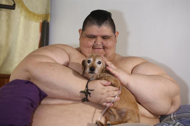 El hombre más obeso del mundo podrá ser operado tras perder más de 175 kilos El hombre más obeso del mundo podrá ser operado tras perder más de 175 kilos