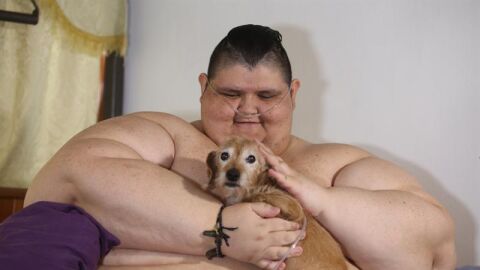 Juan Pedro, el hombre m&aacute;s obeso del mundo, ser&aacute; operado
