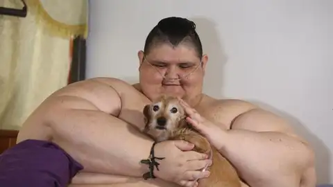 Juan Pedro, el hombre más obeso del mundo, será operado Juan Pedro, el hombre más obeso del mundo, será operado