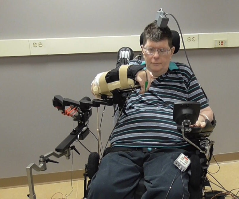 Una prótesis conectada al cerebro permite a un hombre tetrapléjico volver a valerse por sí mismo Una prótesis conectada al cerebro permite a un hombre tetrapléjico volver a valerse por sí mismo