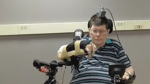 Bill Kochevar probando la neuroprótesis Bill Kochevar, probando la neuroprótesis