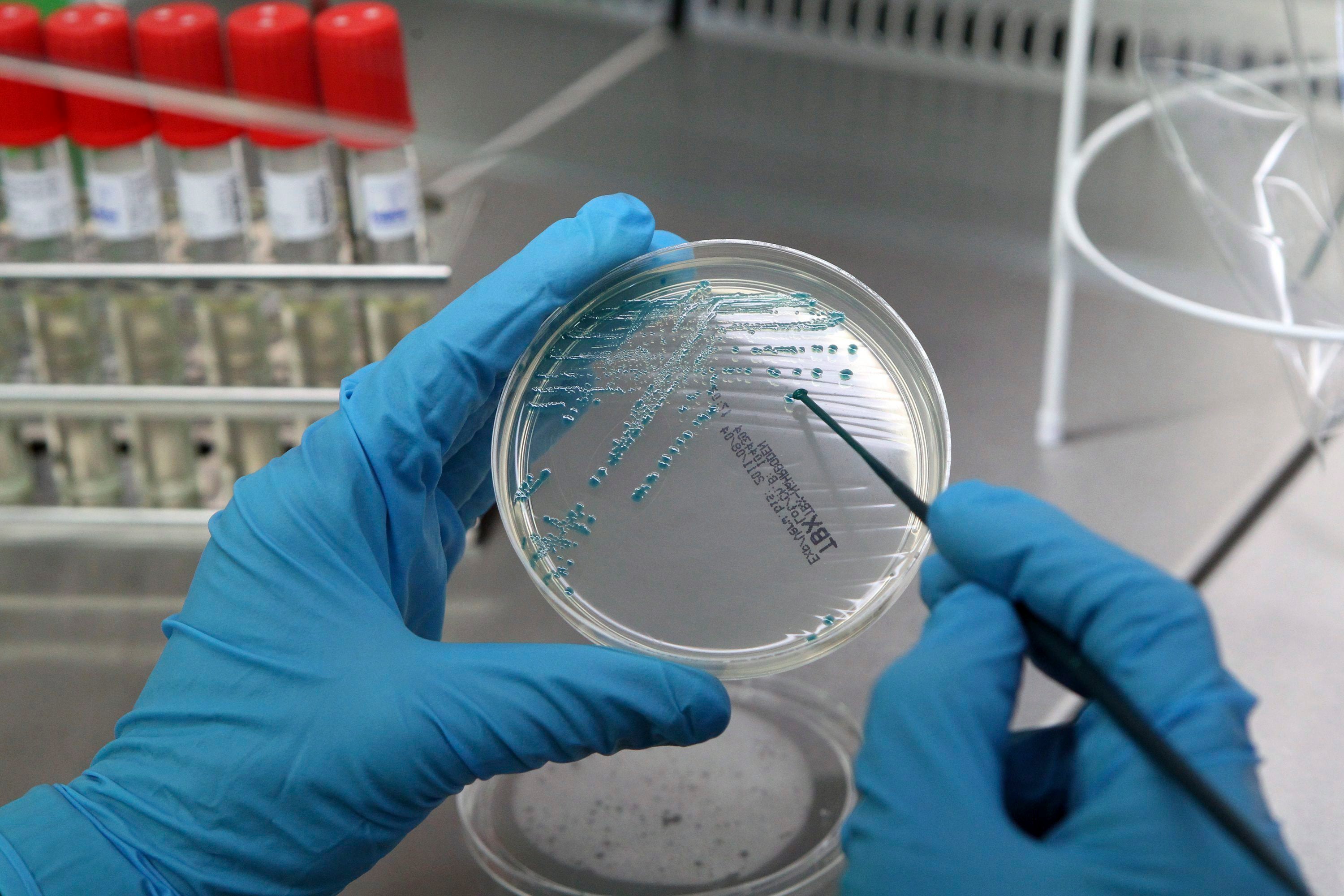 Los efectos secundarios de los tratamientos para la Leishmania Los efectos secundarios de los tratamientos para la Leishmania