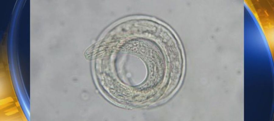 Angiostrongylus cantonensis Angiostrongylus cantonensis