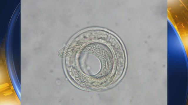 Un parásito letal que ataca al cerebro humano pone en alerta a EEUU Un parásito letal que ataca al cerebro humano pone en alerta a EEUU