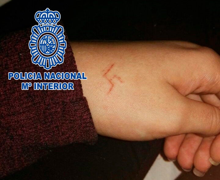 Detenidos seis ultras en Madrid por grabar a fuego una esvástica en la mano de una menor Detenidos seis ultras en Madrid por grabar a fuego una esvástica en la mano de una menor