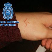 Imagen facilitada por la Policía Nacional de la esvástica que los ultras han grabado a fuego en la mano de la menor