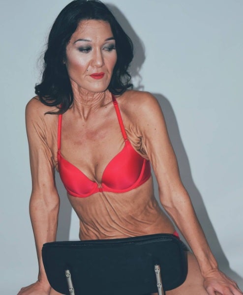 Sara Geurts, la modelo veinteañera con aspecto de anciana que quiere romper los estándares de belleza Sara Geurts, la modelo veinteañera con aspecto de anciana que quiere romper los estándares de belleza