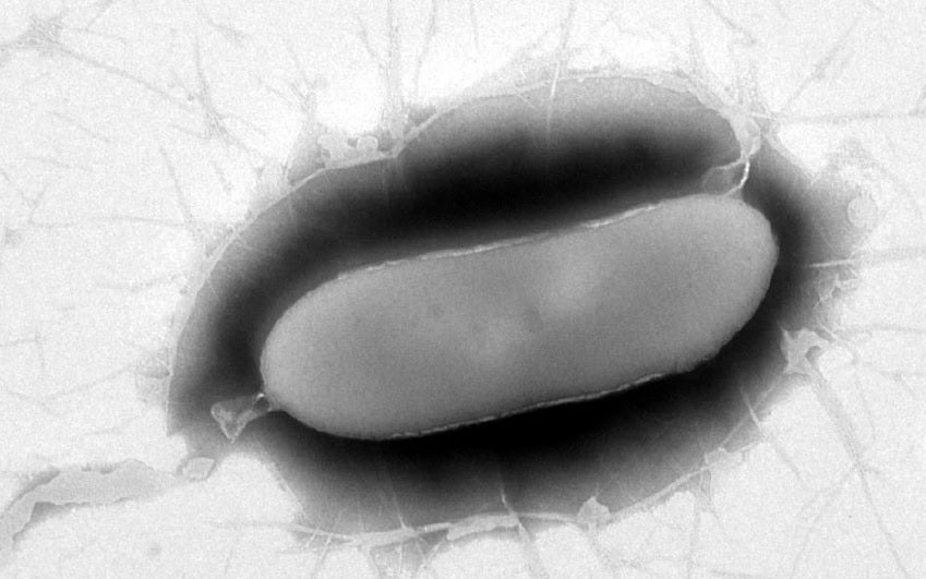 La Brújula de la Ciencia: La bacteria Ideonella Sakaiensis, clave para el medioambiente La Brújula de la Ciencia: La bacteria Ideonella Sakaiensis, clave para el medioambiente