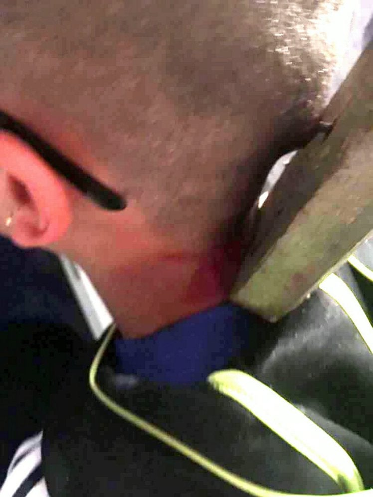Un grupo de menores clava un trozo de madera en la cabeza de un niño con autismo Un grupo de menores clava un trozo de madera en la cabeza de un niño con autismo