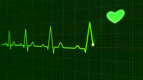 Un biomarcador podría evitar las visitas al cardiólogo por insuficiencia cardíaca. Un biomarcador podría evitar las visitas al cardiólogo por insuficiencia cardíaca.