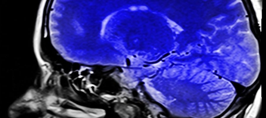 Resonancias magnética Resonancias magnética