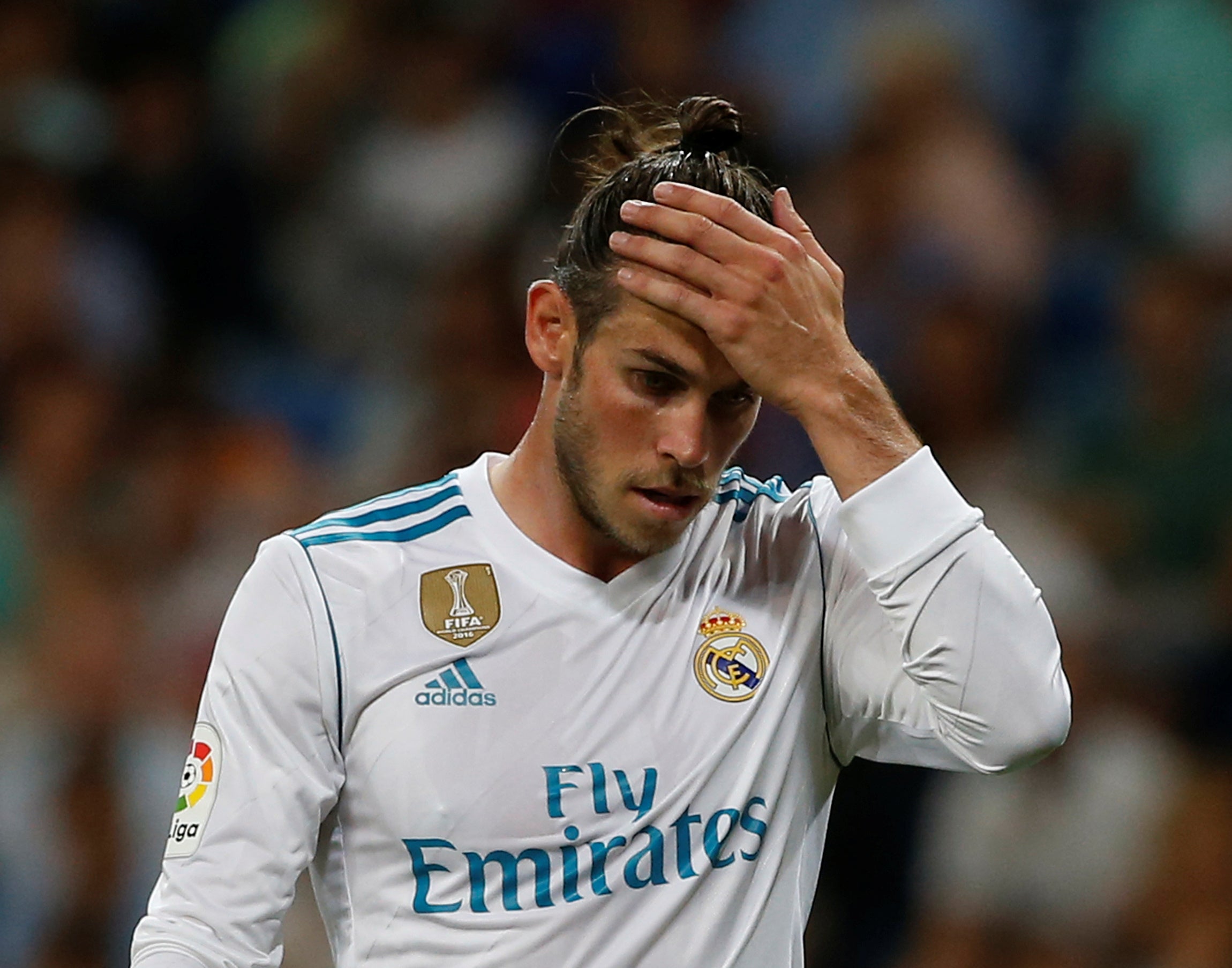 Gareth Bale vuelve a lesionarse: "rotura fibrilar en el aductor de la pierna izquierda" Gareth Bale vuelve a lesionarse: "rotura fibrilar en el aductor de la pierna izquierda"