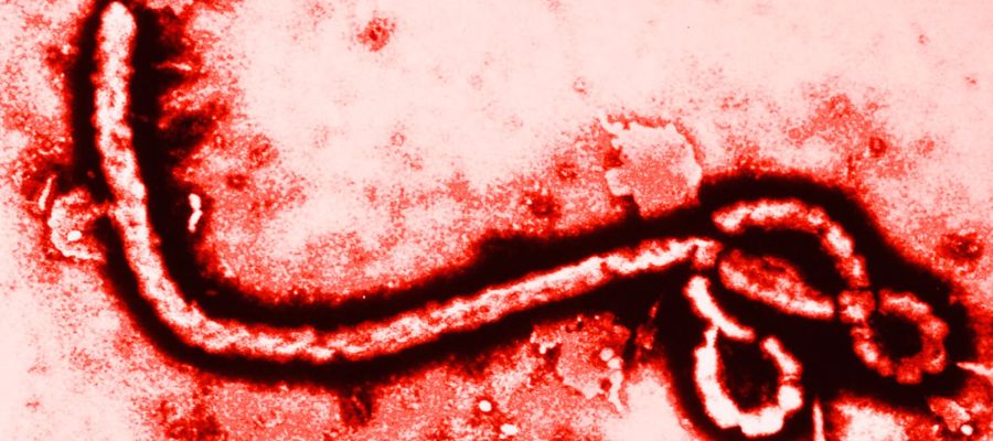 REMEDIO para el ÉBOLA en España REMEDIO para el ÉBOLA en España