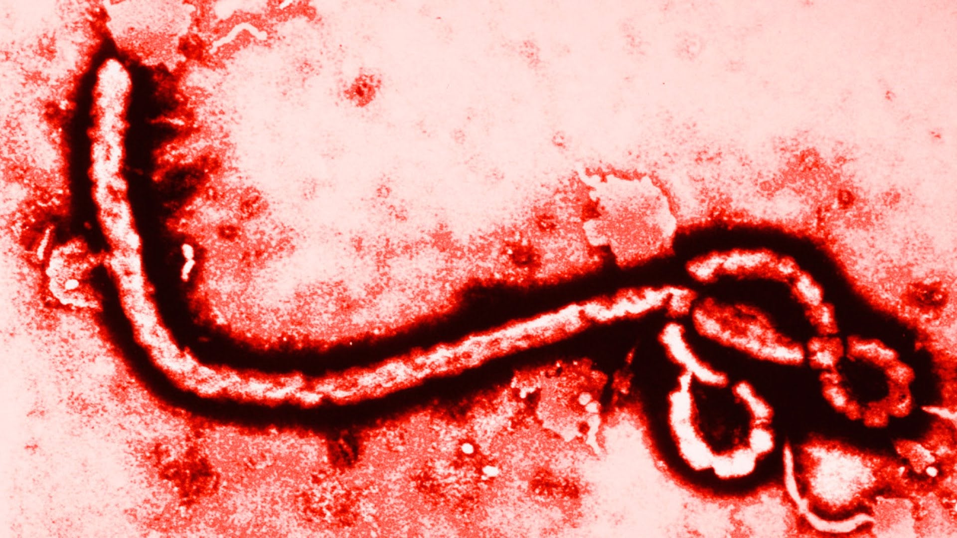 Los supervivientes al ébola generan anticuerpos especiales contra el virus Los supervivientes al ébola generan anticuerpos especiales contra el virus