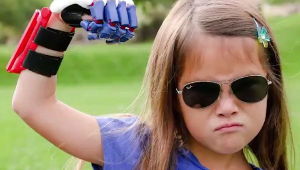Niña de 7 años con prótesis impresa en 3D en su mano derecha