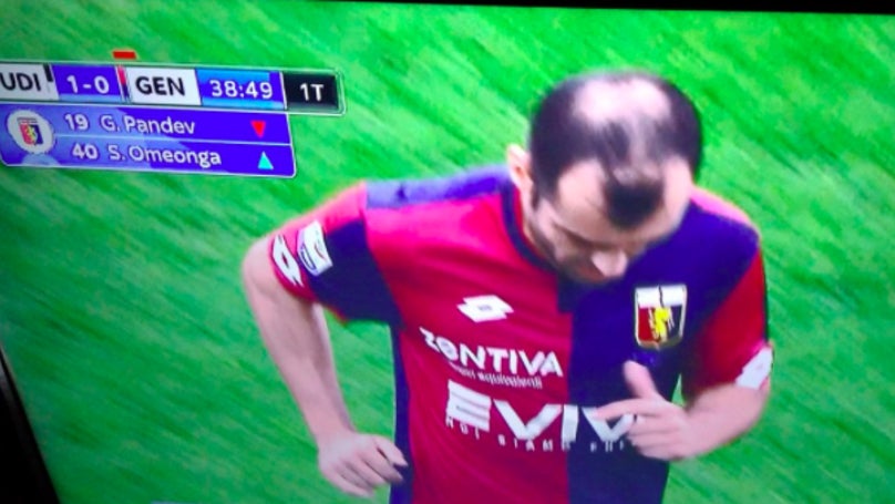 La 'curiosa' forma de la calva en el pelo de Goran Pandev La 'curiosa' forma de la calva en el pelo de Goran Pandev