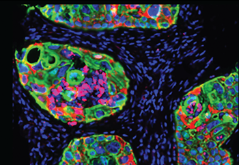La inmunoterapia abrirá una puerta menos tóxica y más efectiva ante el cáncer La inmunoterapia abrirá una puerta menos tóxica y más efectiva ante el cáncer