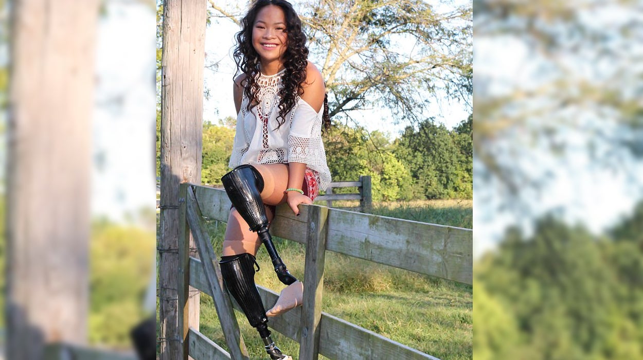 Una joven sin piernas superviviente al suicidio colectivo de sus padres, se prepara para los Juegos Paralímpicos y ser modelo Una joven sin piernas superviviente al suicidio colectivo de sus padres, se prepara para los Juegos Paralímpicos y ser modelo