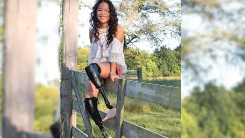 Una joven sin piernas superviviente al suicidio colectivo de sus padres, se prepara para los Juegos Paralímpicos y ser modelo Una joven sin piernas superviviente al suicidio colectivo de sus padres, se prepara para los Juegos Paralímpicos y ser modelo