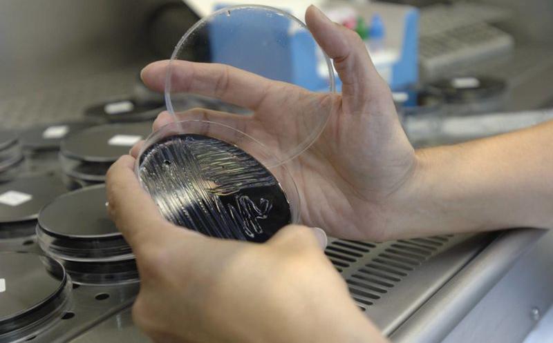 La Fiscalía remite a la provincial de Cáceres la petición de El Defensor del paciente de investigar los casos de legionela La Fiscalía remite a la provincial de Cáceres la petición de El Defensor del paciente de investigar los casos de legionela