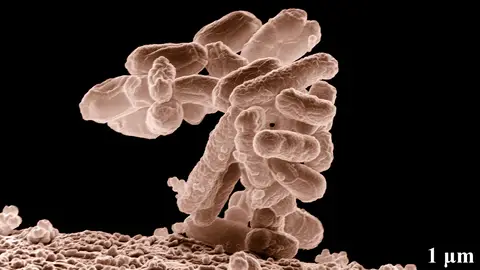 La flora intestinal afecta al exito de la inmunoterapia contra el cancer La flora intestinal afecta al exito de la inmunoterapia contra el cancer