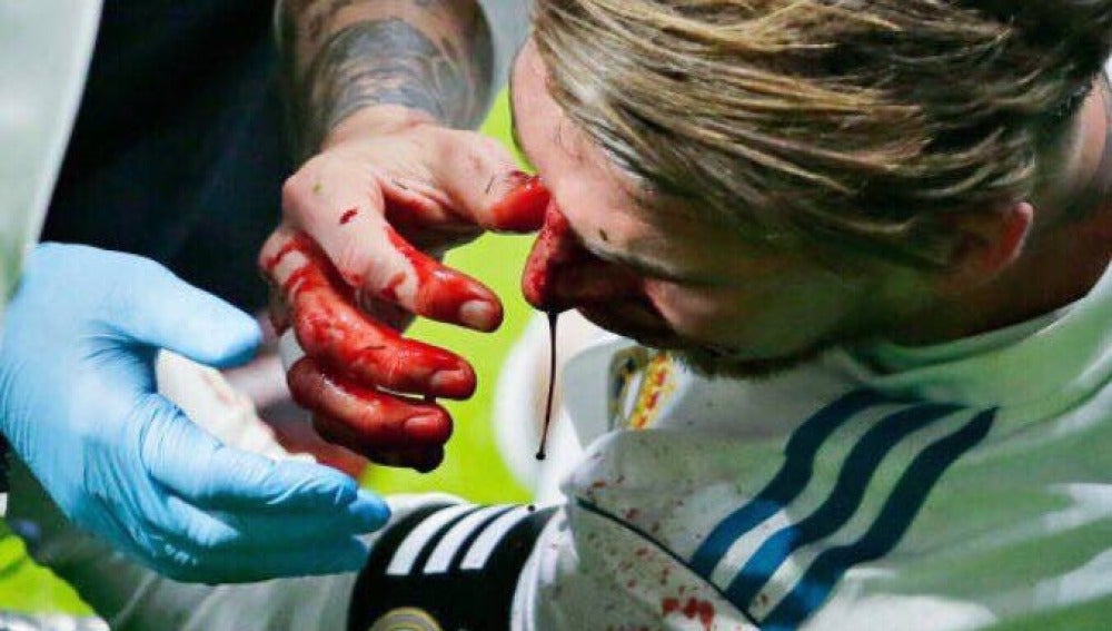 Sergio Ramos, sangrando