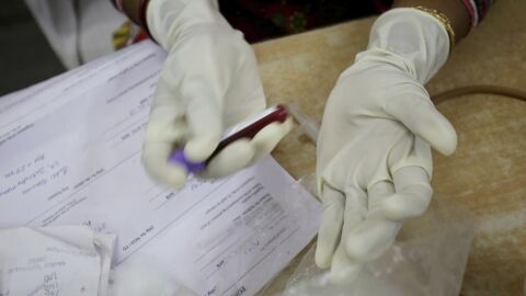 Las cifras del VIH y sida en Espa&ntilde;a: Una de cada cinco personas afectadas por el virus no est&aacute; diagnosticada