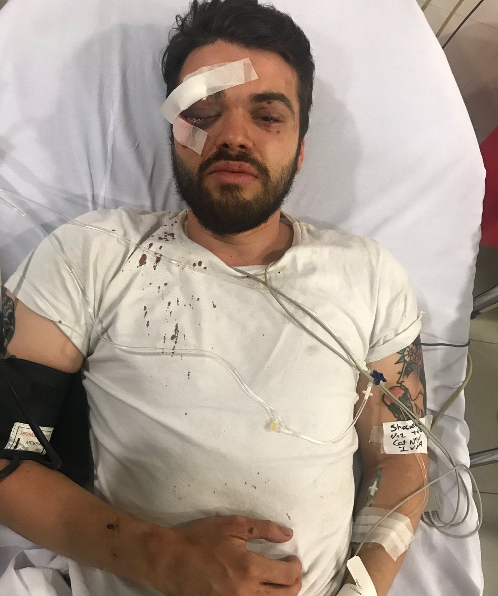 Hospitalizan a un jugador de rugby tras sufrir un supuesto ataque homófobo en un local de comida rápida Hospitalizan a un jugador de rugby tras sufrir un supuesto ataque homófobo en un local de comida rápida