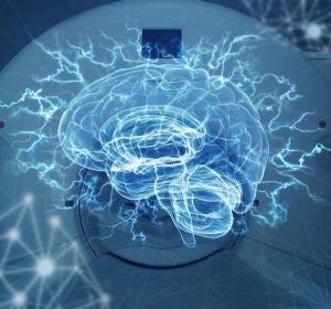 Imagenes del cerebro refutan Imagenes del cerebro refutan