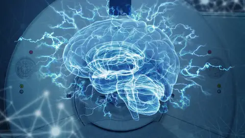 Imagenes del cerebro refutan Imagenes del cerebro refutan
