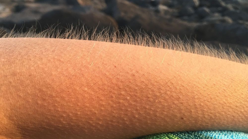 Eureka: Música que pone la piel de gallina Eureka: Música que pone la piel de gallina