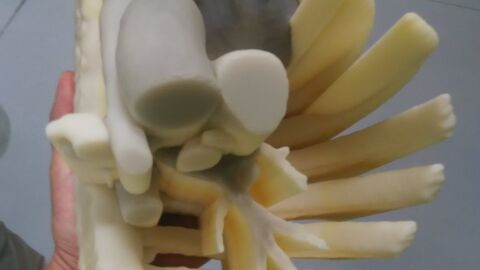 Modelo en 3D del pecho de la ni&ntilde;a fabricado en Martos (Ja&eacute;n)
