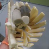 Modelo en 3D del pecho de la niña fabricado en Martos (Jaén)
