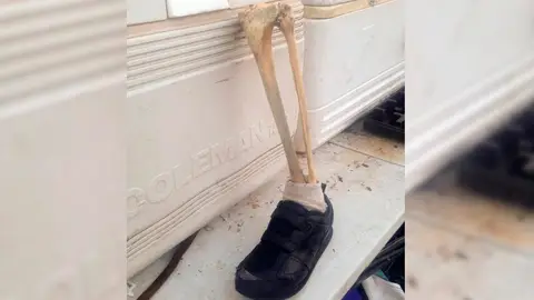 Una pierna humana encontrada en una playa de Canadá Una pierna humana encontrada en una playa de Canadá