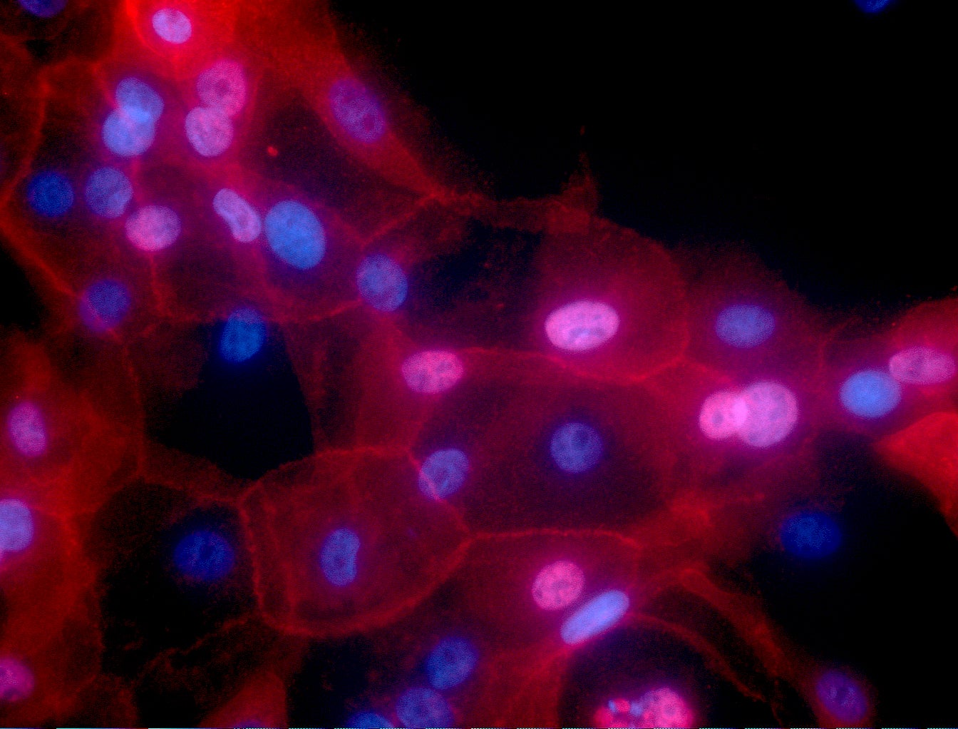 Investigadores identifican una nueva forma de autodestruir el cáncer por estrés Investigadores identifican una nueva forma de autodestruir el cáncer por estrés