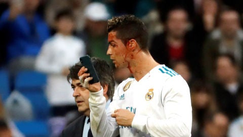 Cristiano Ronaldo, con un m&oacute;vil para verse una herida