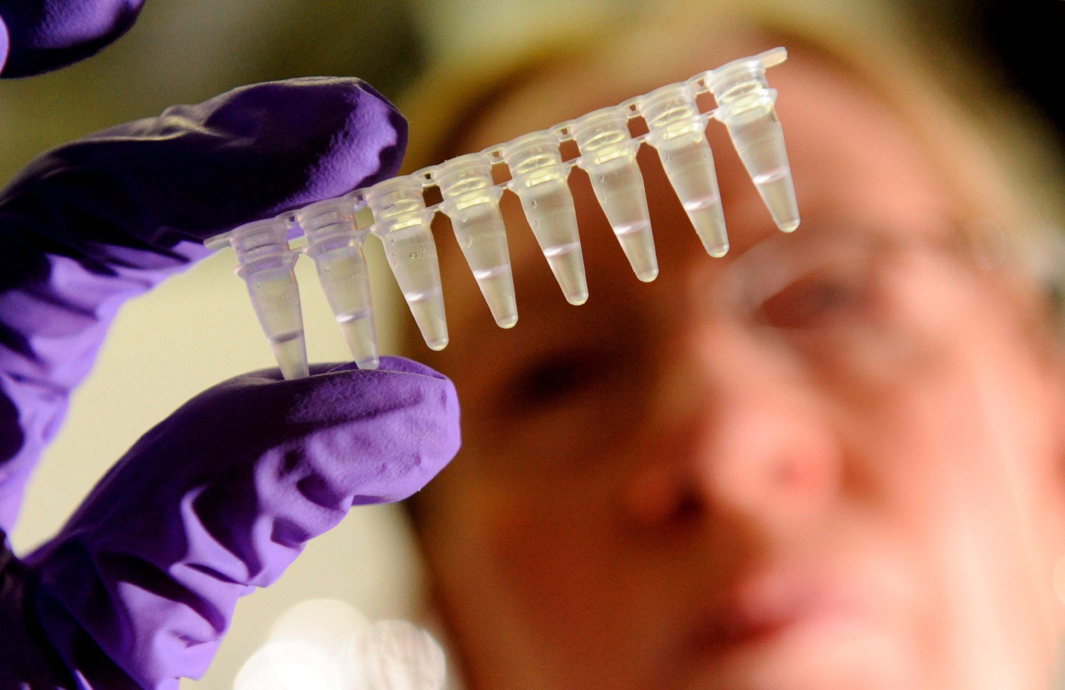 Canarias estrena protocolo PrEP-VIH, dirigido a personas con alto riesgo de infección Canarias estrena protocolo PrEP-VIH, dirigido a personas con alto riesgo de infección