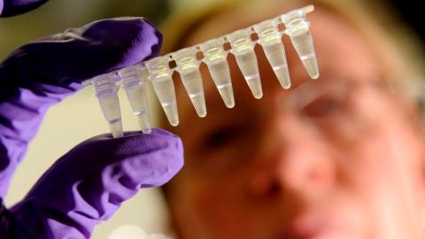 Los avances relacionados con la detecci&oacute;n del VIH son constantes. Esta semana ha llegado a las farmacias espa&ntilde;olas la prueba para el autodiagn&oacute;stico en casa sin necesidad de prescripci&oacute;n m&eacute;dica. Antes, un equipo de cient&iacute;ficos ha desarrollado una c&aacute;psula para administrar los f&aacute;rmacos contra el VIH de una semana. 