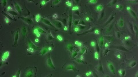 C&eacute;lulas donde las mitocondrias aparecen te&ntilde;idas de verde