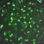 Células donde las mitocondrias aparecen teñidas de verde