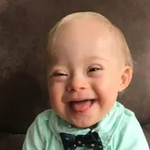 Lucas, el primer bebé con síndrome Down que es imagen de la marca Gerber Lucas, el primer bebé con síndrome Down que es imagen de la marca Gerber