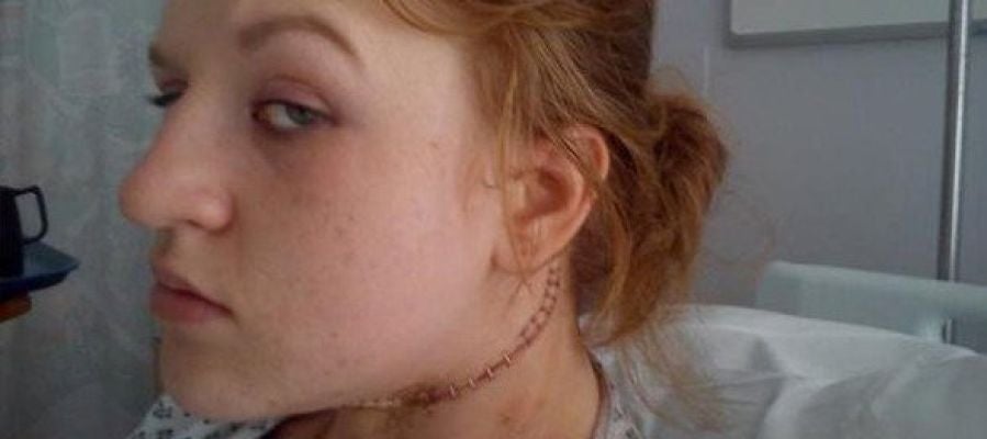 Cerys Head, tras ser operada de cáncer de tiroides Cerys Head, tras ser operada de cáncer de tiroides