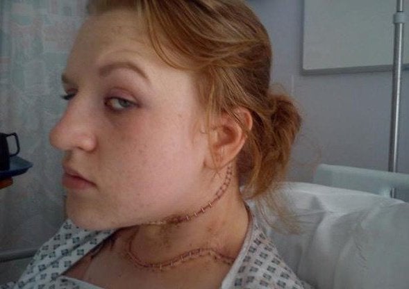 Los médicos confunden el cáncer que padecía una joven con un trastorno alimentario y le recomiendan comer más Los médicos confunden el cáncer que padecía una joven con un trastorno alimentario y le recomiendan comer más