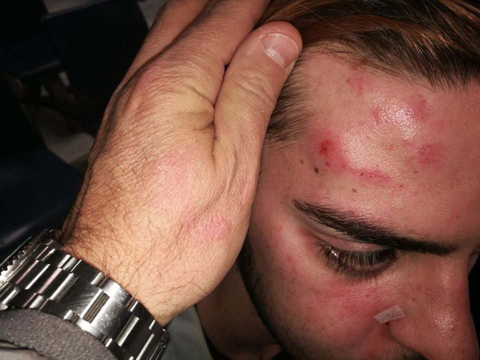 Las víctimas de un ataque homófobo en Palma animan a denunciar este tipo de agresiones Las víctimas de un ataque homófobo en Palma animan a denunciar este tipo de agresiones