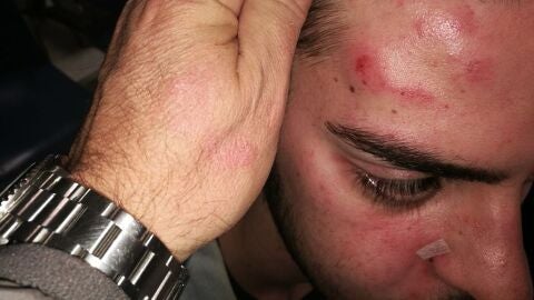 V&iacute;ctima de una agresi&oacute;n hom&oacute;foba en Palma