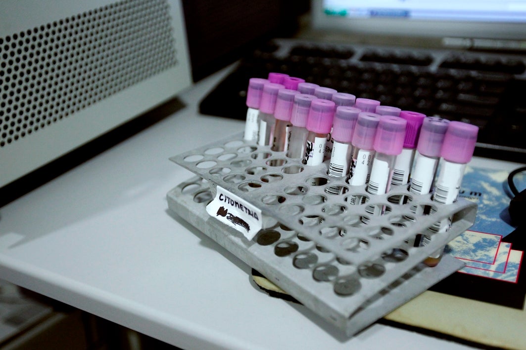 Se disparan un 63% los casos de chlamydia en Canarias Se disparan un 63% los casos de chlamydia en Canarias