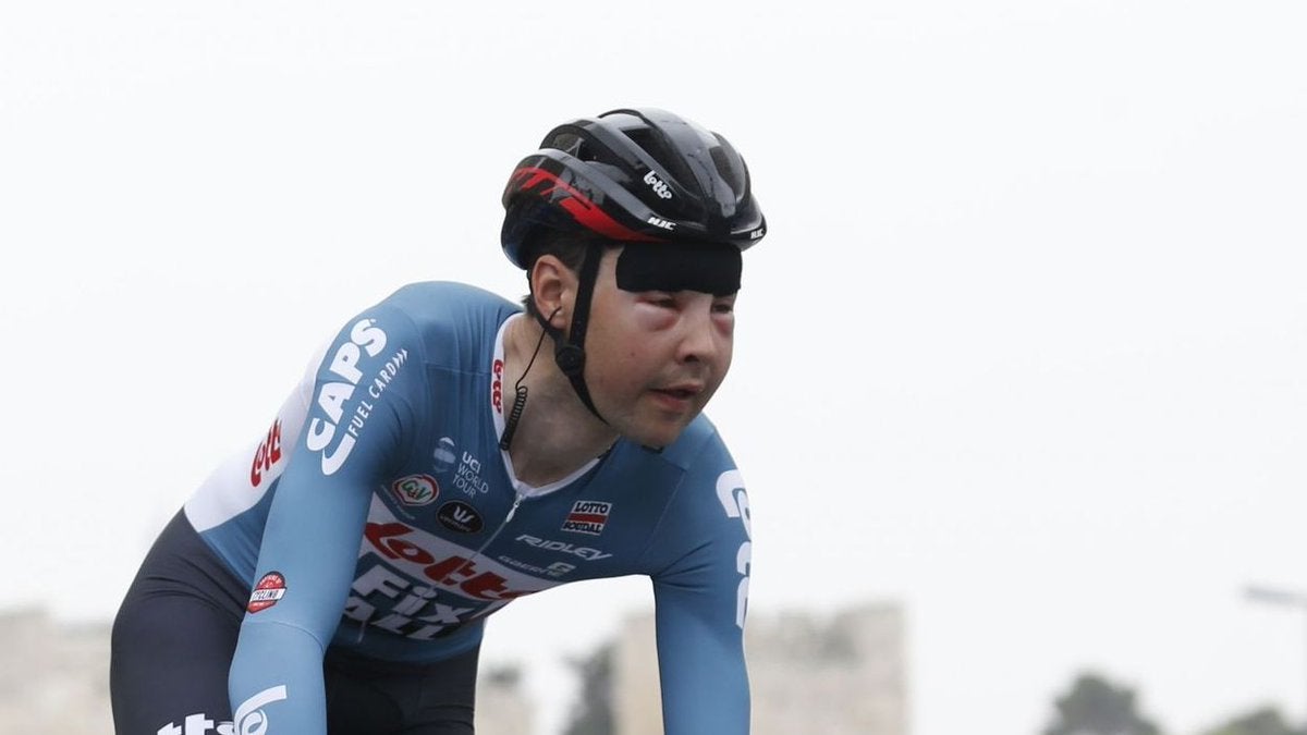 Un ciclista corre el Giro con la cara hinchada por la picadura de una avispa y no medicarse por miedo al dopaje Un ciclista corre el Giro con la cara hinchada por la picadura de una avispa y no medicarse por miedo al dopaje