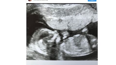Ecograf&iacute;a del vig&eacute;simo primer hijo de la familia Radford