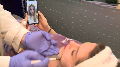 Los 'selfies' con filtros condicionan cada vez m&aacute;s las operaciones est&eacute;ticas en la cara 